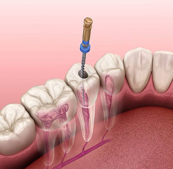 Endodontia